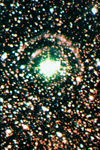 Light Echoes around SN1987A