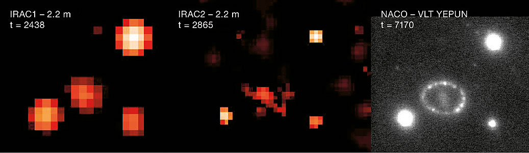 A Ring Around SN1987A