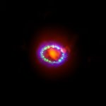 Composite image of Supernova 1987A