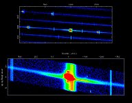 H-alpha Emission in SN1987A